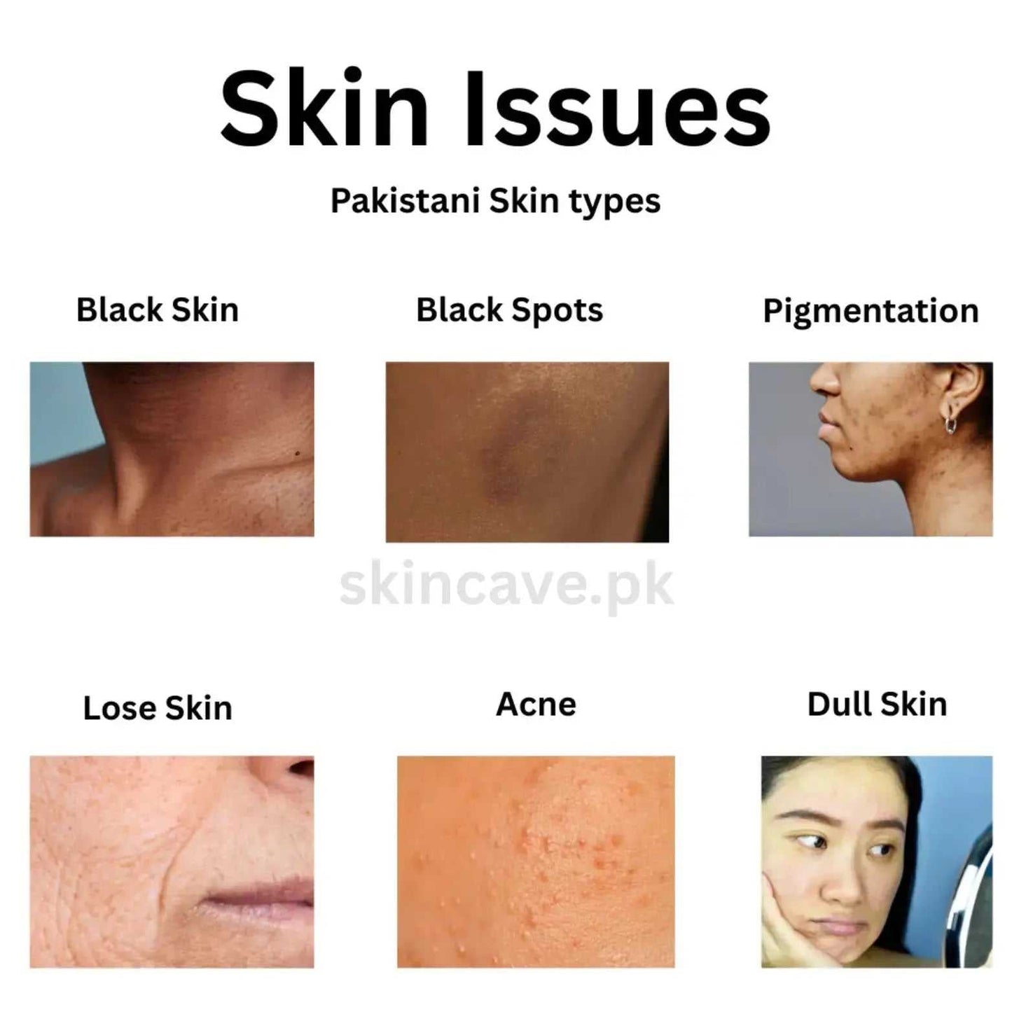 Pixis Whitening Cream | Reduce DarkSpots + Sunblock - Skin Cave