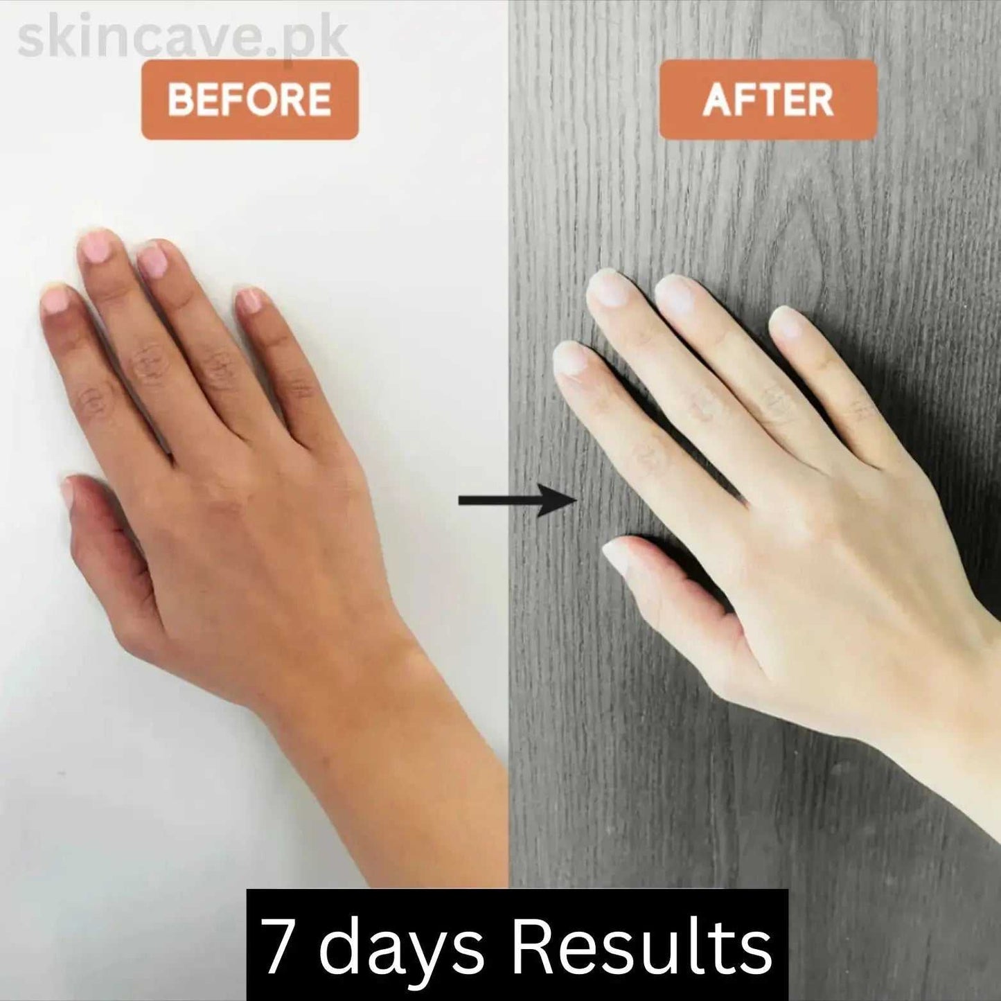 Pixis Whitening Cream | Reduce DarkSpots + Sunblock - Skin Cave