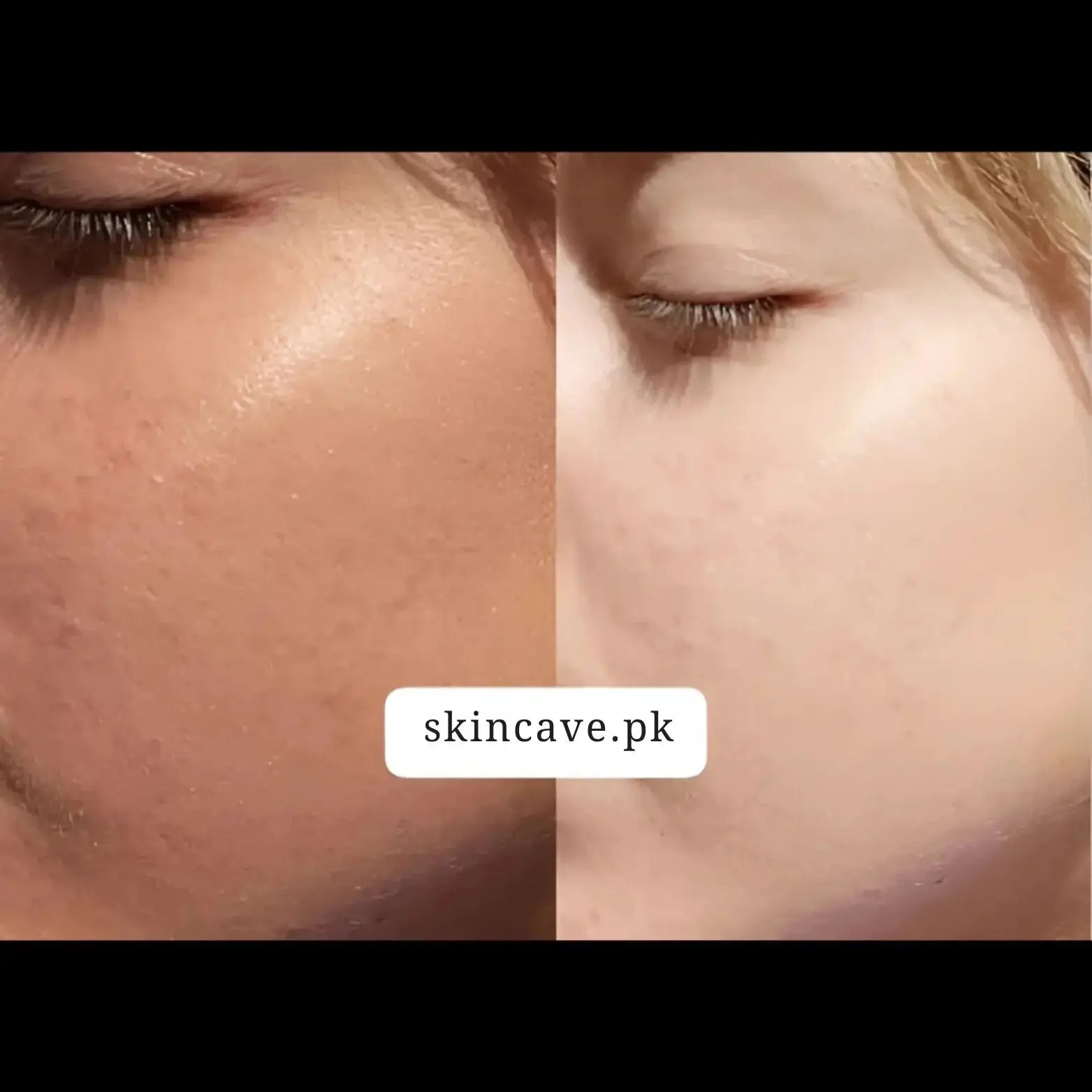 Pixis Whitening Cream | Reduce DarkSpots + Sunblock - Skin Cave