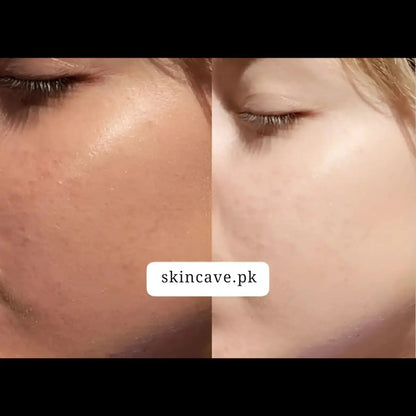 Pixis Whitening Cream | Reduce DarkSpots + Sunblock - Skin Cave